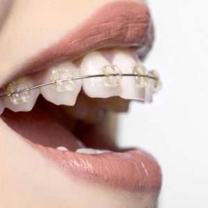 clinica ortodontia osasco