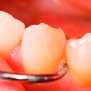 periodontia em osasco