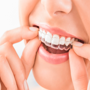 aparelho para dente - ortodontia